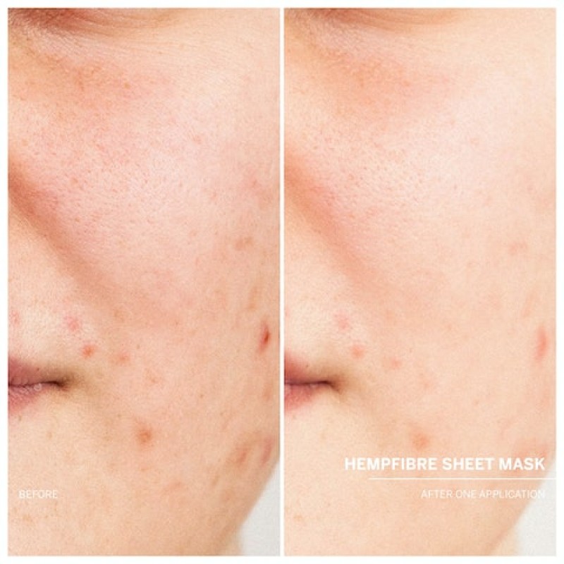 DOCCLEANHempfibersheetmask-00