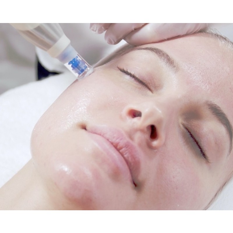 MicroneedlingfrapandetildcolletinklAftercarest-01