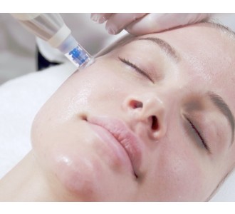 Microneedling ansigtsbehandling inkl. aftercare sæt