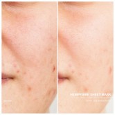 DOCCLEANHempfibersheetmask-00