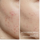 ActivePurifyier-00