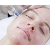 MicroneedlingfrapandetildcolletinklAftercarest-01